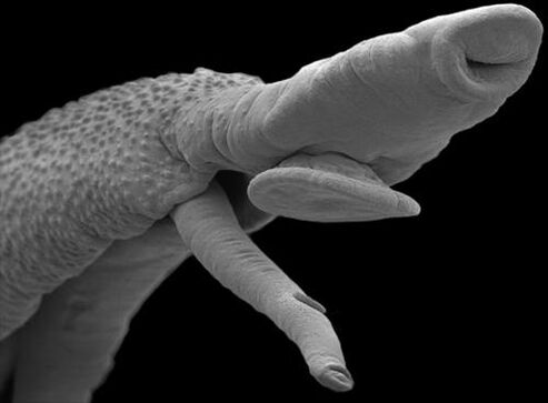 parasitic organism